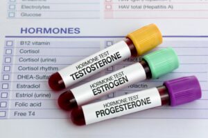 Comparing Bioidentical Hormones and Synthetic Hormones. Tubes of hormone tests sitting on a results checklist.